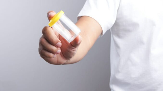 employment-drug-screening-servic