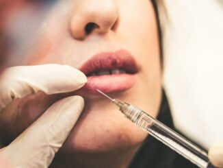 Botox behandling ; laser hårfjerning