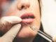 Botox behandling ; laser hårfjerning